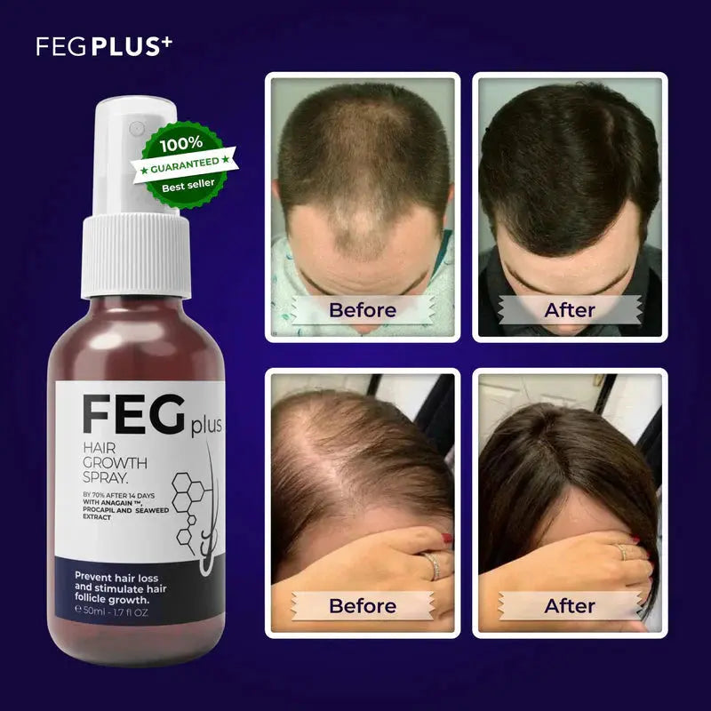 FEG Hairs Gwoth Serum